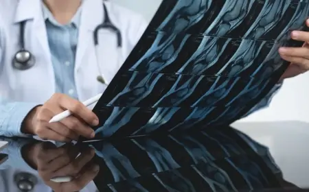 University of Surrey Researchers Develop AI Model to Predict Knee X-rays One Year Ahead Transforming Osteoarthritis Care