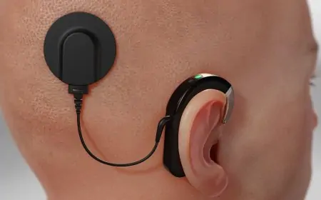 Cochlear Achieves Edge AI Breakthrough with Machine Learning Implants Inside Human Body